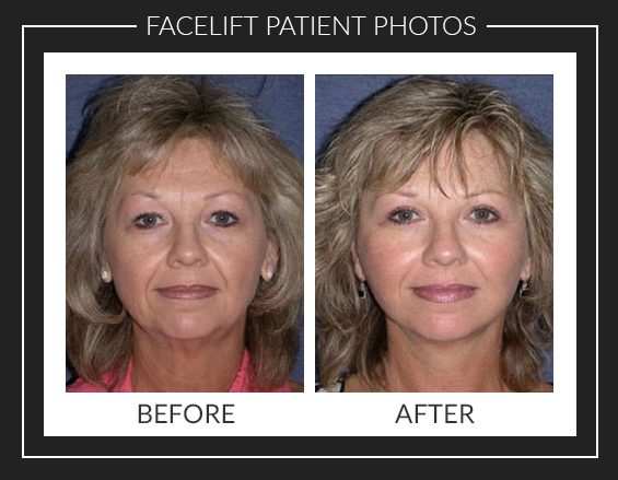 Photo Gallery Photo Gallery